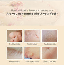 Load image into Gallery viewer, Foot Scrub Exfoliating Massager
