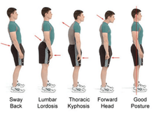 Load image into Gallery viewer, Body Fit Adjustable Posture Corrector