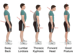 Body Fit Adjustable Posture Corrector